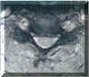 figur5b.jpg (17516 byte), klicka s� visas originalbilden